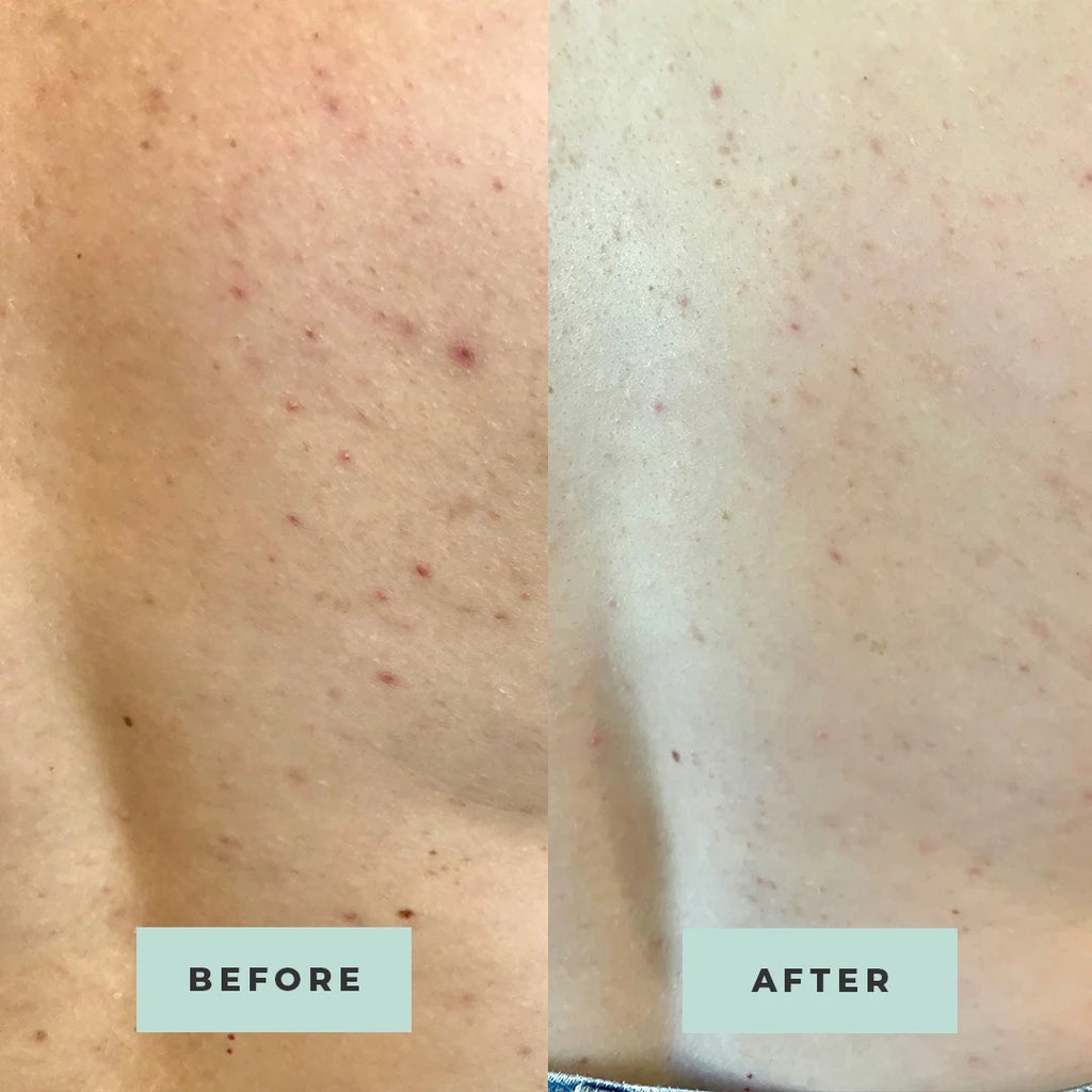 Oregano-powered Bum + Body Cream Kit of 2 P252011