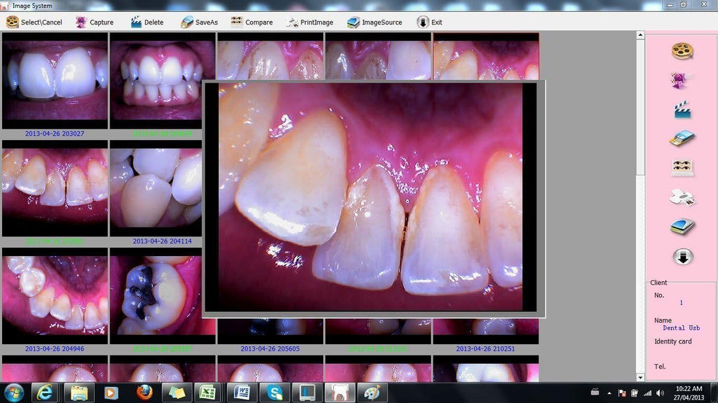 Intraoral Camera U6966